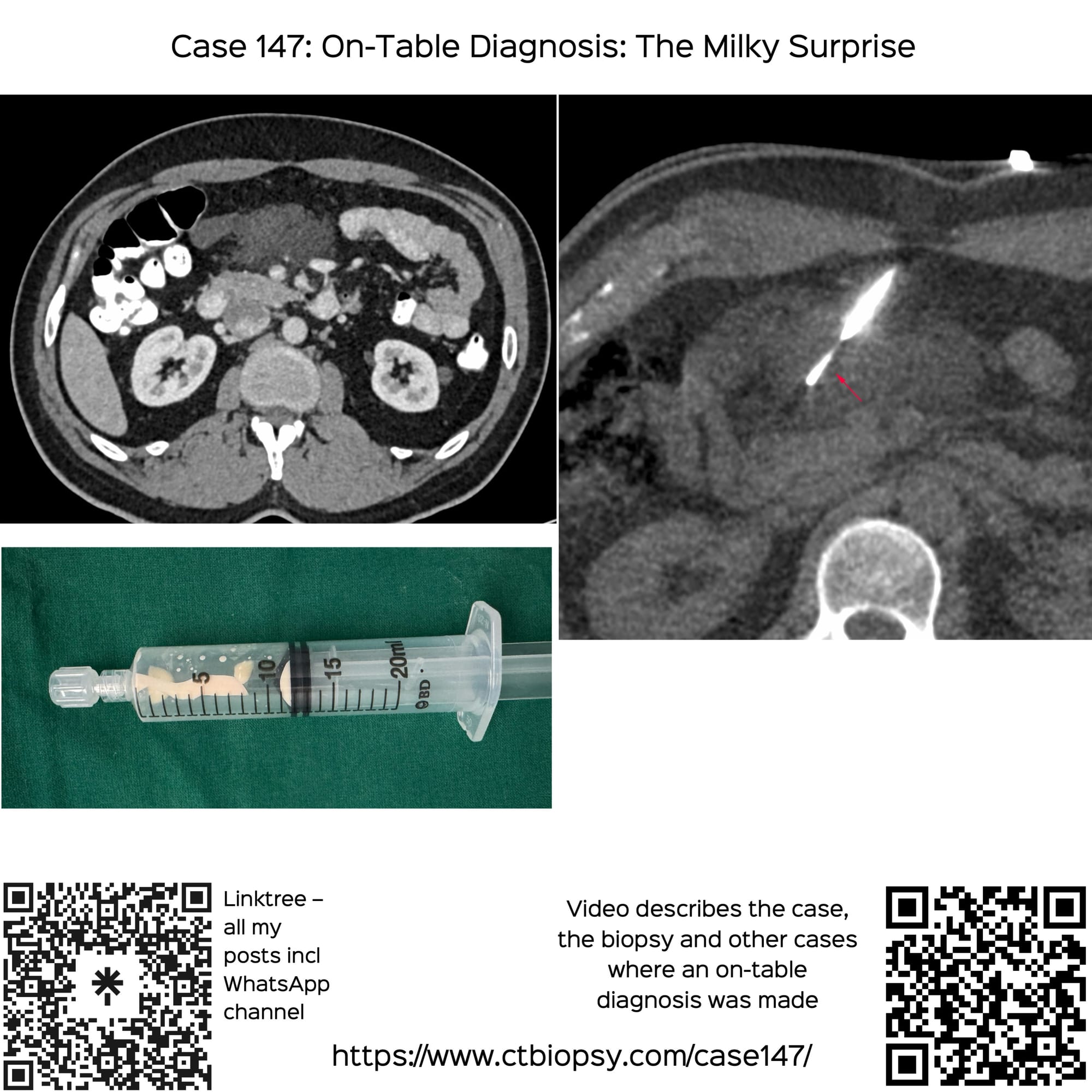 Case 147: On-Table Diagnosis - The Milky Surprise