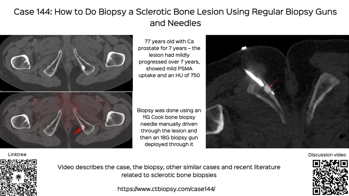Lecture: The Role of Image-Guided Biopsy - When the Biopsy Makes the "World of a Difference"